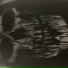 The BlackShirts