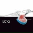 LCJG